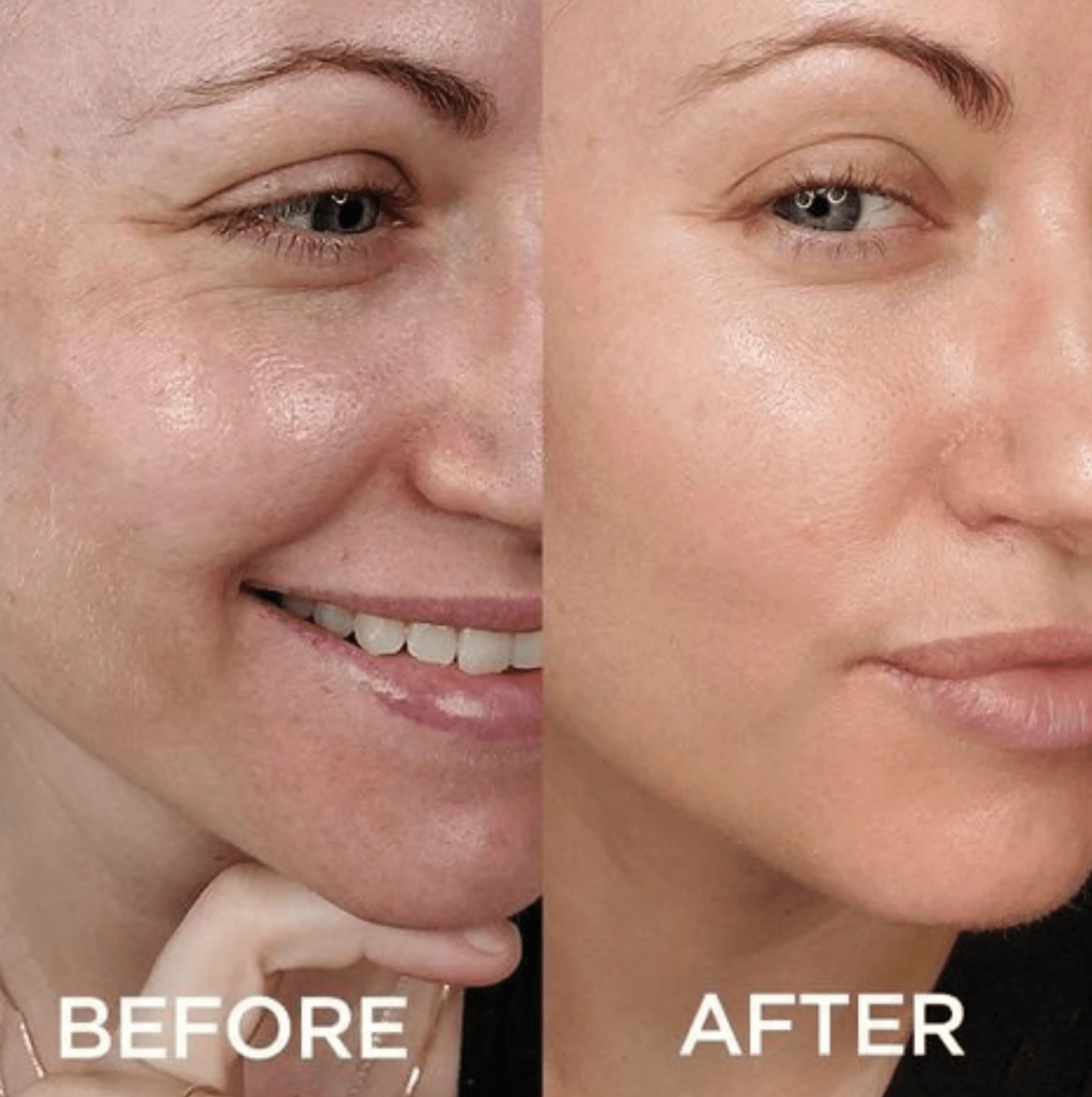 Complete Skin Renewal kit