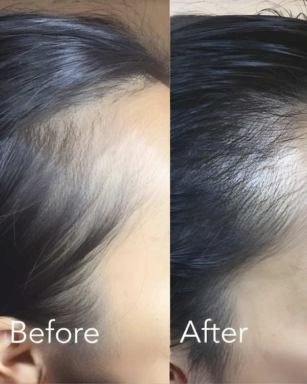 Is Batana Oil the Ultimate Upgrade from Jojoba Oil for Hair & Skin Care?