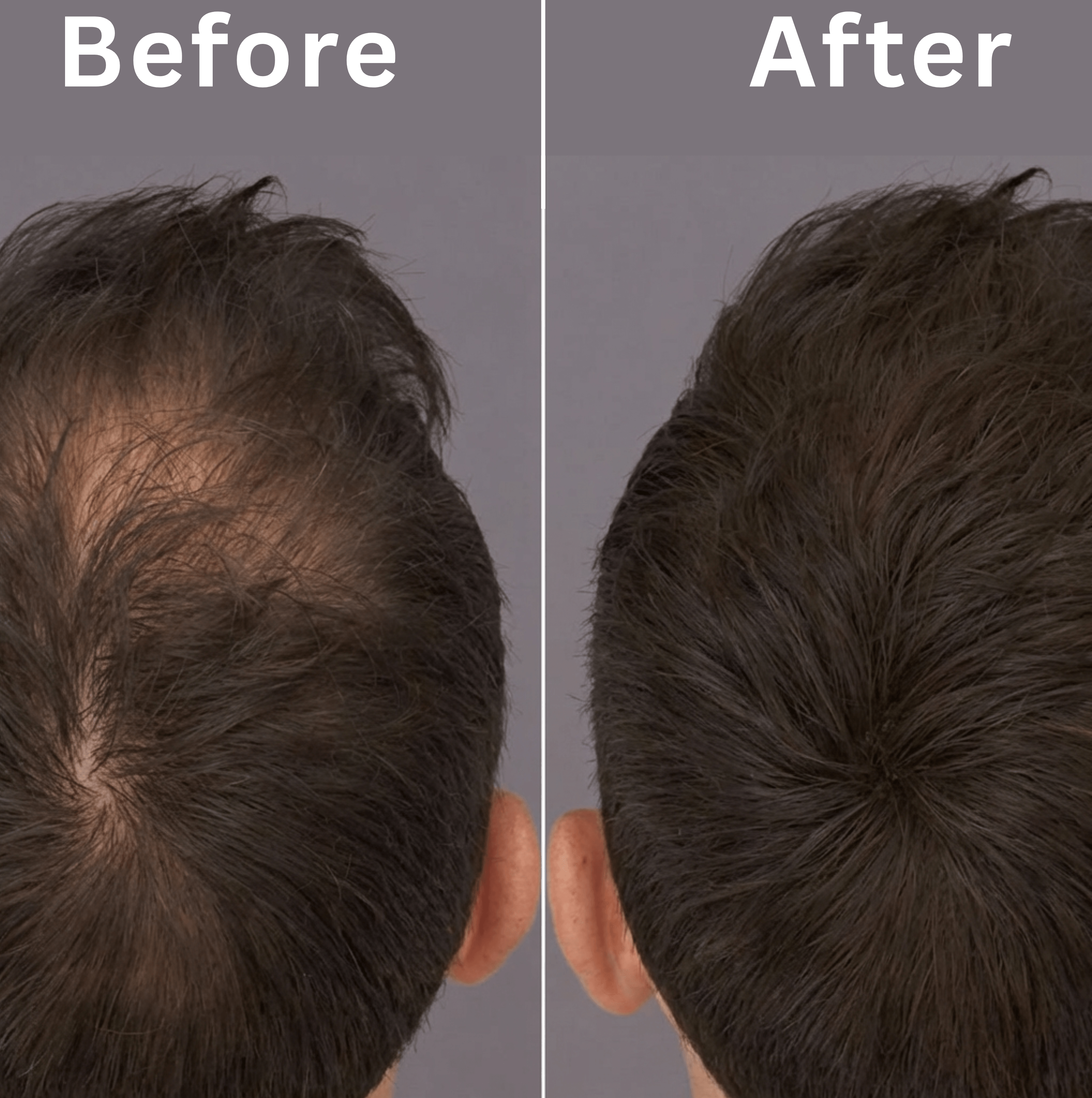 Why You Should Switch from Rosemary Oil to a Complete Hair Care Routine